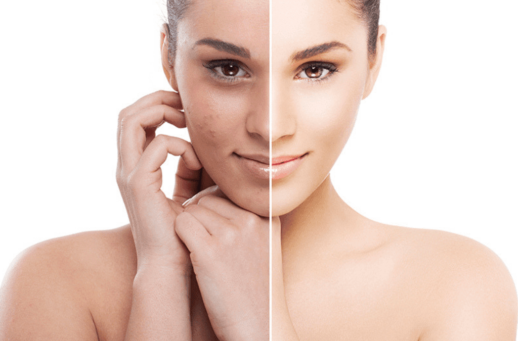 Shedding Light on Pigmentation