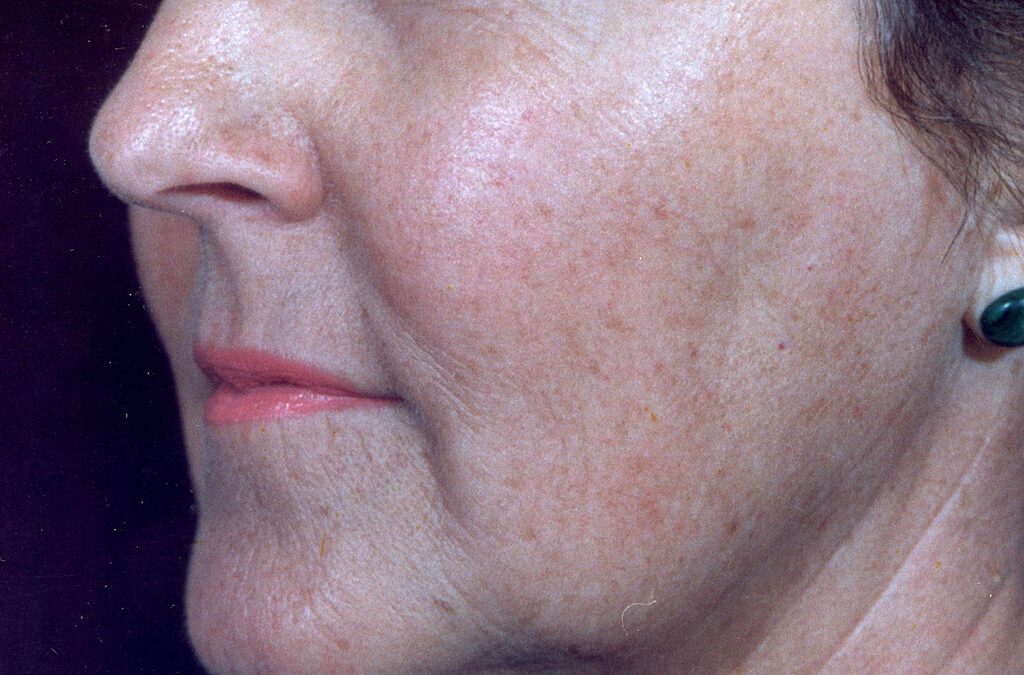 Ageing