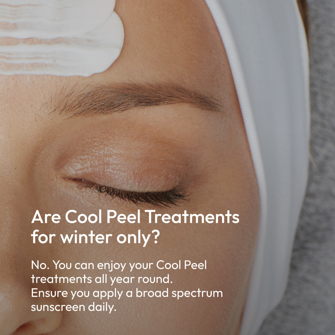 Cool Peel May SM Post Thumbnail